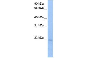 WB Suggested Anti-SPATA12 Antibody Titration:  0. (SPATA12 anticorps  (N-Term))