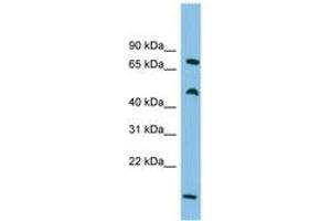 Image no. 1 for anti-Ecdysoneless Homolog (ECD) (C-Term) antibody (ABIN6744684) (ECD/SGT1 anticorps  (C-Term))