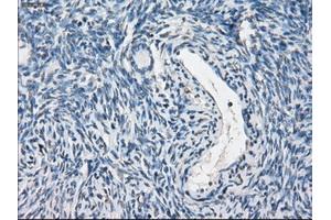 Immunohistochemical staining of paraffin-embedded colon tissue using anti-PPP5Cmouse monoclonal antibody. (PP5 anticorps)