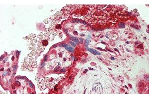 Detection of ORM2 in Human Placenta Tissue using Polyclonal Antibody to Orosomucoid 2 (ORM2) (Orosomucoid 2 anticorps)