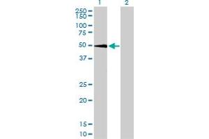 Western Blot analysis of SGK expression in transfected 293T cell line by SGK monoclonal antibody (M01), clone 4D7-G3. (SGK1 anticorps  (AA 1-431))