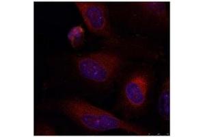 Image no. 2 for anti-Jun B Proto-Oncogene (JUNB) (AA 77-81) antibody (ABIN197138) (JunB anticorps  (AA 77-81))