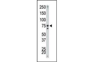 The anti-IKK alpha Pab (ABIN6243793 and ABIN6579033) is used in Western blot to detect IKK alpha in mouse spleen tissue lysate.