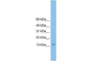 WB Suggested Anti-CHCHD1 Antibody Titration: 0. (CHCHD1 anticorps  (Middle Region))