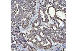 IHC analysis of RTCB using anti-RTCB antibody (ABIN7600722). (C22orf28 anticorps  (AA 227-505))