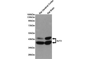 Western blot detection of SirT2 in Rat Cerebral Cortex and Rat Brain lysates using SirT2 mouse mAb (1:1000 diluted).