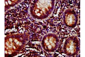 anti-CD27 Molecule (CD27) (AA 20-191) antibody