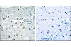 Immunohistochemistry analysis of paraffin-embedded human brain, using PLA2G4D Antibody. (PLA2G4D anticorps  (AA 531-580))