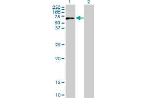 Western Blotting (WB) image for anti-UPF3 Regulator of Nonsense Transcripts Homolog A (UPF3A) (AA 274-375) antibody (ABIN599587)