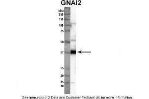 Sample Type: Nthy-ori cell lysate (50ug)Primary Dilution: 1:1000Secondary Antibody: anti-rabbit HRPSecondary Dilution: 1:2000Image Submitted By: Anonymous (GNAI2 anticorps  (C-Term))