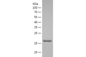 Western Blotting (WB) image for RNA Binding Motif Protein 3 (RBM3) (AA 1-157) protein (His tag) (ABIN7124923)