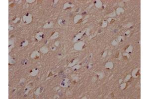 IHC image of ABIN7127505 diluted at 1:100 and staining in paraffin-embedded human brain tissue performed on a Leica BondTM system.