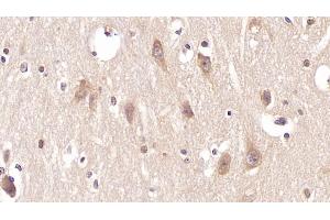 Detection of PTHR2 in Human Cerebrum Tissue using Monoclonal Antibody to Parathyroid Hormone Receptor 2 (PTHR2)