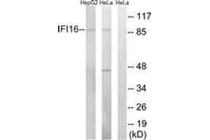 Western blot analysis of extracts from HeLa/HepG2 cells, using IFI16 Antibody. (IFI16 anticorps  (AA 731-780))