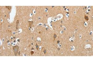 Immunohistochemistry of paraffin-embedded Human brain using DSCR1 Polyclonal Antibody at dilution of 1:45 (RCAN1 anticorps)