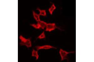 ABIN6272251 staining COLO205 by IF/ICC. (ARRDC4 anticorps  (Internal Region))