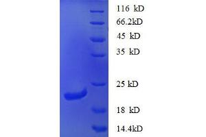Chemokine (C-X-C Motif) Ligand 16 (CXCL16) (AA 27-198), (partial) protein (His tag)