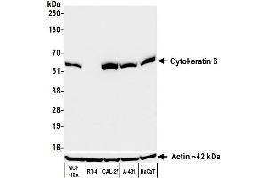 anti-Keratin 6 (KRT6) (C-Term) antibody