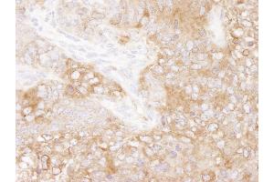 Immunohistochemistry (IHC) image for anti-Eukaryotic Translation Elongation Factor 2 (EEF2) (AA 808-858) antibody (ABIN7448956) (EEF2 anticorps  (AA 808-858))