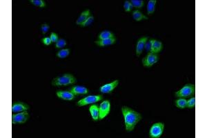 Immunofluorescent analysis of HepG2 cells using ABIN7151138 at dilution of 1:100 and Alexa Fluor 488-congugated AffiniPure Goat Anti-Rabbit IgG(H+L)