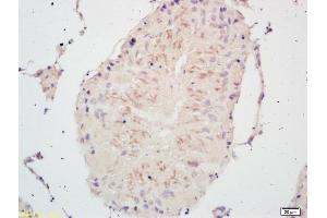 Formalin-fixed and paraffin embedded rat testis labeled with Rabbit Anti PSCA Polyclonal Antibody, Unconjugated (ABIN671676) at 1:200 followed by conjugation to the secondary antibody and DAB staining (PSCA anticorps  (AA 24-123))