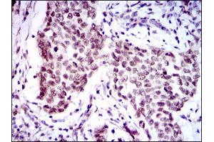 Image no. 1 for anti-Forkhead Box P1 (FOXP1) antibody (ABIN1491561) (FOXP1 anticorps)