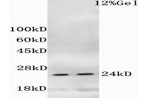 L1 mouse liver, L2 mouse cerebrum lysates probed (ABIN685183) at 1:200 in 4 °C.