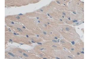 DAB staining on IHC-P; Samples: Mouse Heart Tissue