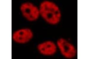 ABIN6277771 staining HeLa by IF/ICC.