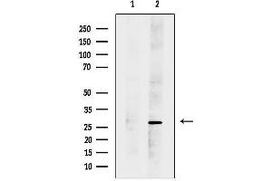 anti-Der1-Like Domain Family, Member 2 (DERL2) (C-Term) antibody