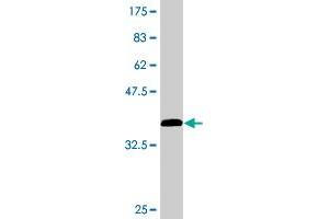Western Blot detection against Immunogen (37. (TBCA anticorps  (AA 1-108))