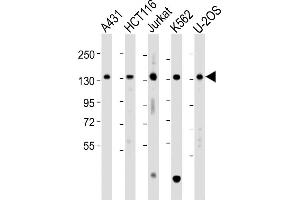 All lanes : Anti-TACC3 Antibody (Center) at 1:2000 dilution Lane 1: A431 whole cell lysate Lane 2: HC whole cell lysate Lane 3: Jurkat whole cell lysate Lane 4: K562 whole cell lysate Lane 5: U-2OS whole cell lysate Lysates/proteins at 20 μg per lane. (TACC3 anticorps  (AA 317-350))