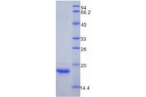 SDS-PAGE analysis of Mouse Myoglobin Protein.