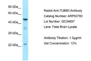 Western Blotting (WB) image for anti-Tubulin, beta 3 (TUBB3) (C-Term) antibody (ABIN2774381) (TUBB3 anticorps  (C-Term))