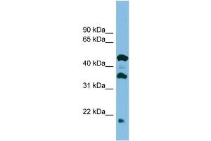 WB Suggested Anti-C11orf73 Antibody Titration: 0. (C11orf73 anticorps  (Middle Region))