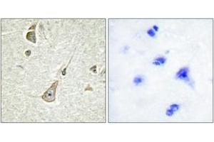 Immunohistochemistry analysis of paraffin-embedded human brain tissue, using PCDH-X/Y Antibody. (PCDH-X/Y (AA 531-580) anticorps)