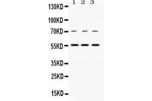 Western blot analysis of Visfatin expression in rat brain extract ( Lane 1), mouse cardiac muscle extract ( Lane 2), and human placenta extract ( Lane 3).
