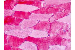 Anti-GPR30 antibody IHC of human skeletal muscle.