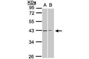 WB Image Sample(30 ug whole cell lysate) A:293T B:H1299 10% SDS PAGE antibody diluted at 1:1000 (GALR2 anticorps  (C-Term))