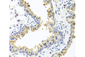 Immunohistochemistry of paraffin-embedded Mouse lung using HSPA6 Polyclonal Antibody at dilution of 1:100 (40x lens).