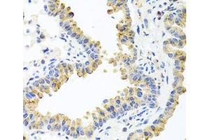 Immunohistochemistry of paraffin-embedded Mouse lung using HSPA6 Polyclonal Antibody at dilution of 1:100 (40x lens). (HSPA6 anticorps)