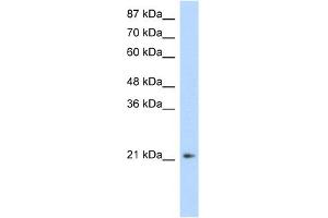 WB Suggested Anti-FERD3L Antibody Titration:  1. (FERD3L anticorps  (N-Term))