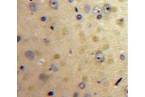 Used in DAB staining on fromalin fixed paraffin-embedded Brain tissue (Apelin anticorps  (AA 24-77))