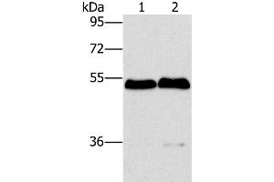 Western Blot analysis of Mouse brain and liver tissue using SPHK2 Polyclonal Antibody at dilution of 1:200 (SPHK2 anticorps)