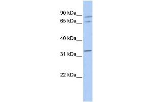 WB Suggested Anti-GJA4 Antibody Titration:  0. (GJA4 anticorps  (Middle Region))