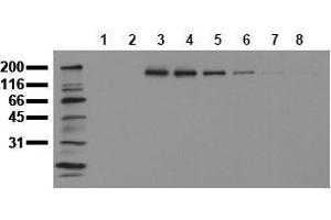 Western Blotting (WB) image for anti-Receptor tyrosine-protein kinase erbB-2 (ErbB2/Her2) (pTyr1112) antibody (ABIN126789) (ErbB2/Her2 anticorps  (pTyr1112))