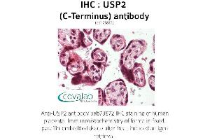Image no. 1 for anti-Ubiquitin Specific Peptidase 2 (USP2) (C-Term) antibody (ABIN1740601) (USP2 anticorps  (C-Term))