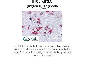 Image no. 1 for anti-Kinesin Family Member 5A (KIF5A) (Internal Region) antibody (ABIN1736222) (KIF5A anticorps  (Internal Region))