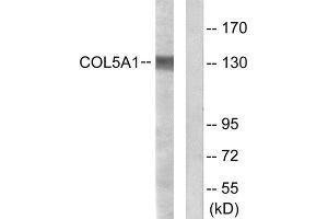 Western Blotting (WB) image for anti-Collagen, Type V, alpha 1 (COL5A1) (Internal Region) antibody (ABIN1850288) (COL5A1 anticorps  (Internal Region))