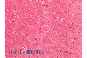 ABIN768567 (5µg/ml) staining of paraffin embedded Human Cortex. (SOD2 anticorps  (Internal Region))